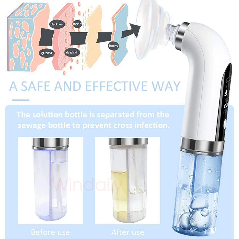 2025 Blackhead Remover Vacuum – Electric Pore Cleaner USB Rechargeable ✨